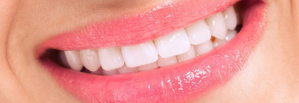 white-teeth